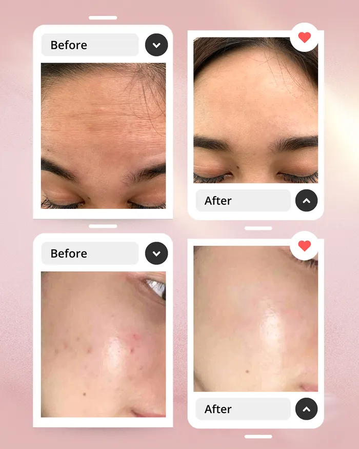 before-after-1_2_11zon.webp