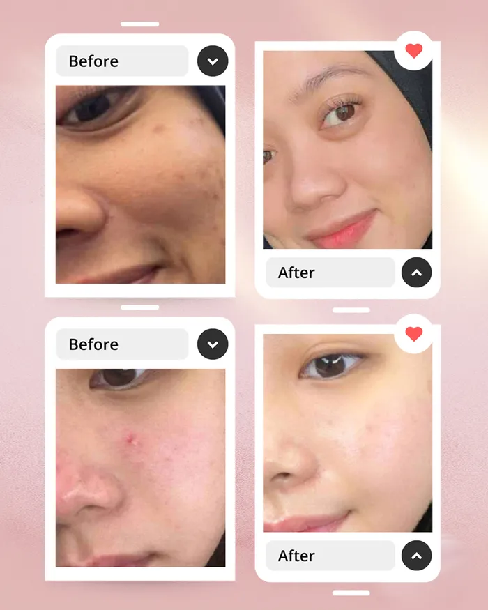 before-after-2_3_11zon.webp