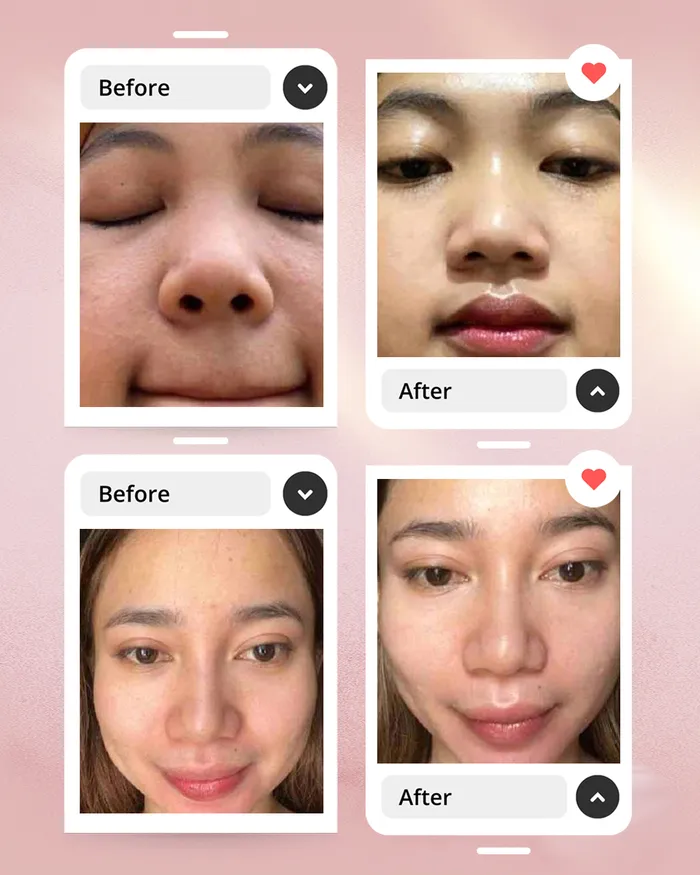 before-after-3_4_11zon.webp